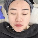 제이(J)에스테틱 - 서구 | 대구 진천동 피부관리 제이우에스테틱 후기 | 열감·트러블 진정 효과 제대로 봄
