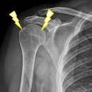 어깨사랑마취통증의학과의원 이미지