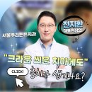 오오치과병원 | 연제구 크라운치과, 씌운 치아에도 충치가 생길 수 있을까요?