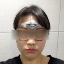 슈퍼비젼바이오메디칼 | 만성두통때문에 고생하다 찾은 약물치료말고 세팔리(CEFALY)치료 후기