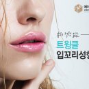 더좋은성형외과의원 네이버블로그