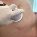 탑클래스PC | [탑뷰티클래스 인하대역점]에서 어깨·등 뭉침 해결! &#39;승모근·등관리 잘하는곳&#39;