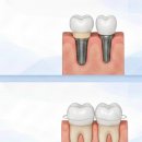 이-라인치과기공소 이미지