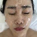 나디브위생뷰티서산예천F | 서산피부관리 미모리폼 / 1회만으로도 효과가 확실했던 트리플리프팅 후기