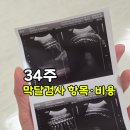 34 | 막달검사 항목 비용, 임신 34주 검사 후기
