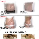 준메디컬 Daum카페