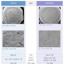 밝은세상안과의 인트라 라식수술의 장단점 이미지