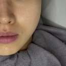 별나라문구 | 올리지오 300샷 후기 | 팔자주름 신경쓰이는 30대 후반 생얼고수의 솔직 후기