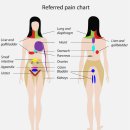 고대병원앞(18301) | 고대안암병원 8cm담낭(쓸개) 제거 로봇수술 후기: 특식