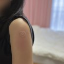 순천기독의원 | 화이자 백신3차 부스터샷 접종 후기(근육통,간지럼)