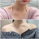 뿌리깊은한의원 | [1년 후기] 피브로한의원 서초 l 켈로이드 피부 한의원 점빼기 뿌리깊은 점 피침요법 후기