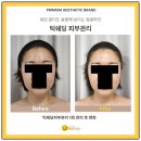 삼영빌딩 | 명동 얼굴형 교정 관리 얼굴라인 변화 원리와 실제 사례 후기