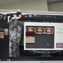 혁신치과의원 | 원주 치과, 원주 치아미백 잘하는 곳 후기(내돈내산)