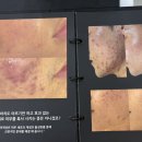 라인랩커스텀 | 청주 윤곽관리 피아나뷰티랩에서 1회 받고 땅콩형 라인 대만족한 솔직 후기