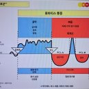 뼈와 관절 - 치유 단계 이미지