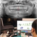 다음치과기공소 이미지