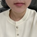 누브의원 네이버블로그