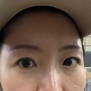 우원컨설팅 | 미금역 분당 눈썹 문신제거 붉은 잔흔 제거 솔직후기 브로우원