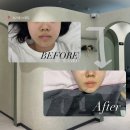 편안한에스테틱 - 연제구 과정로343번길 22 | 춘천 피부관리샵 추천 | 꼼꼼하고 편안한 수기관리 “MZ 에스테틱” 방문후기♥