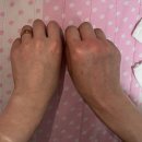 이손약국 | 고양이한테 물렸을 때 대처방법 / 병원 입원 생생 후기