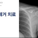 범성 정형외과의원 네이버블로그