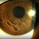 에스스포츠 이미지