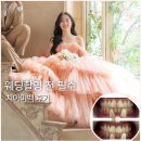 미소홍커피 | 치아미백 후기｜웨딩촬영 전 직접 받아본 가격·통증·유지기간 총정리