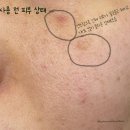 SNP 시알 베리어 세럼 &amp; 크림으로 피부 장벽 강화하세요.