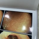 정승화내과 네이버블로그