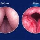 고려리프트 이미지