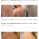 진성광고사 | 병의원 온라인 광고 진행 시 진행할 수 있는 기본 매체정리 (SA, 블로그마케팅)