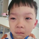 도담소아청소년과 | [해열주사 부작용 후기] 일본 여행 후 고열… 해열주사 맞고 생긴 부작용