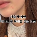 큐병원 | [공지] 큐메디온 프로더마 클리너 솔직 후기 : 여드름, 사춘기 트러블 효과