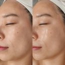 용인수지피부관리샵 &#39;나나스킨케어 왁싱&#39; 홍조 기미피부 잘하는 곳 후기