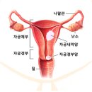 여성은 꼭 보세요 20년 새 완전히 달라진 '자궁암' 지도. 이미지