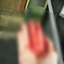 상처흉터관리)손가락 꼬맨후 / 꼬맴 상처 손가락 (흉터관리, 통증, 손가락봉합)6개월 후기