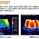 가정의료기 이미지