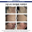 고운누리피부과