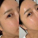 바이오회사화장품 잔주름관리 보닉스 엘씨 세럼