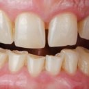 맑은미소치과의원 이미지