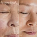 화연에스테틱 이미지