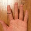 [[정보]] 손목터널증후군일때 수지침 치료점은 어디입니까? 이미지