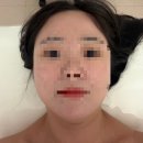 미엠아이 | 영등포 피부관리 미엠아이에스테틱 신부관리 윤곽관리 후기