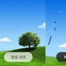 눈 비문증 원인 진단 비문증 눈에아지랑이 날파리증 이미지