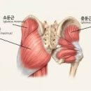 사정 후 통증 10년차 - 근육으로 접근해야 할까요? 이미지