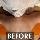 더뷰티나다 | 필수 강남신부관리 청담에스테틱 뷰티블르바드에서 상체관리 받고 온 후기