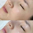 안민로-1 | 쉽게 붉어지는 건조한 피부 창원피부관리 하앤에스테틱 진정 재생 케어 후기