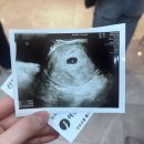 피움산부인과의원 이미지