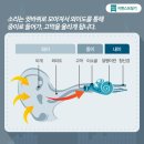 독일시그니아보청기 서면센터 이미지