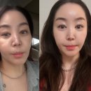 전원홈그린 | 메디큐브 에이지 알 하이 포커스 샷 후기｜무한 샷 하이 푸 홈 케어 600샷